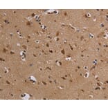 Immunohistochemistry - KCNK13 Antibody from Signalway Antibody (36567) - Antibodies.com