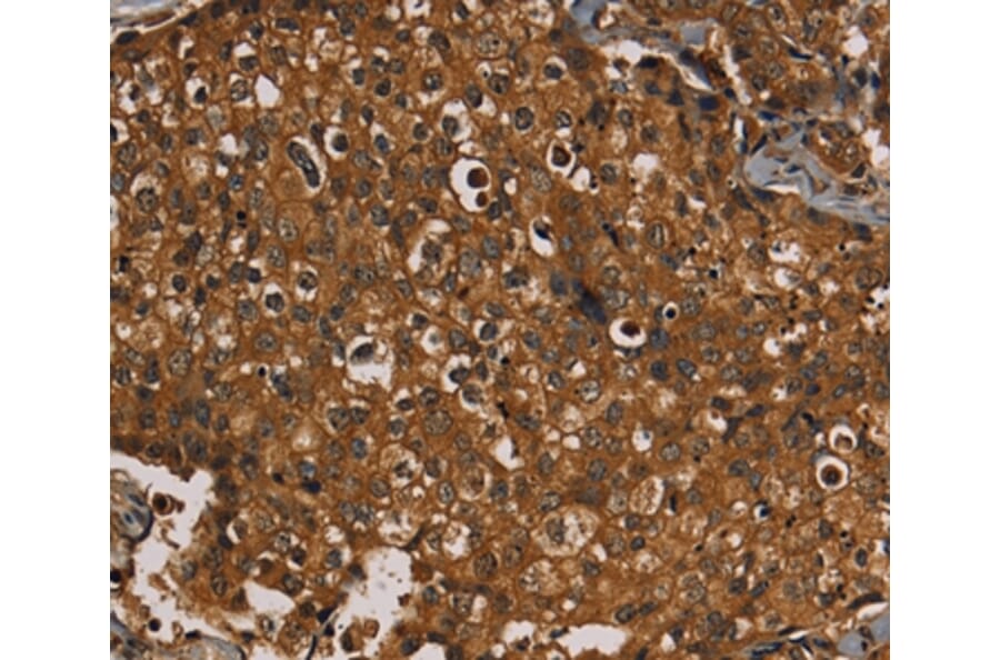 Immunohistochemistry - KIF20A Antibody from Signalway Antibody (36571) - Antibodies.com