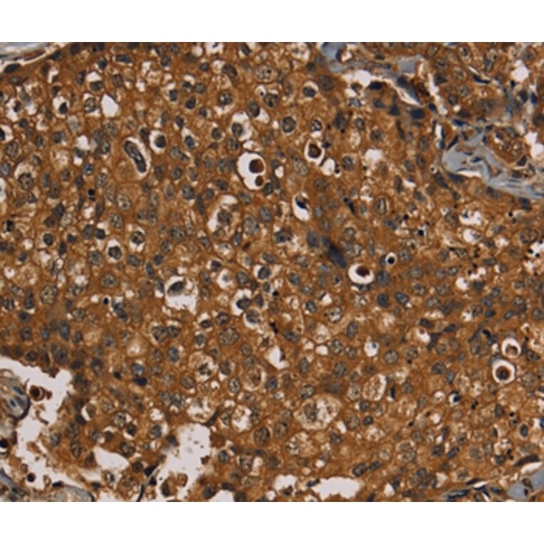 Immunohistochemistry - KIF20A Antibody from Signalway Antibody (36571) - Antibodies.com