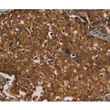Immunohistochemistry - KIF20A Antibody from Signalway Antibody (36571) - Antibodies.com