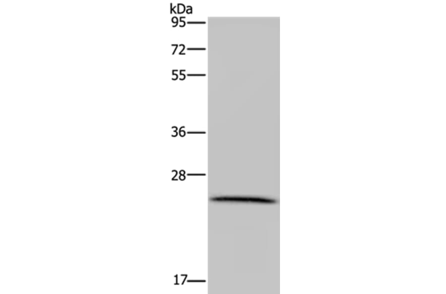 LRRC57 Antibody from Signalway Antibody (36590) - Antibodies.com