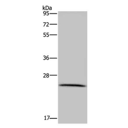 LRRC57 Antibody from Signalway Antibody (36590) - Antibodies.com