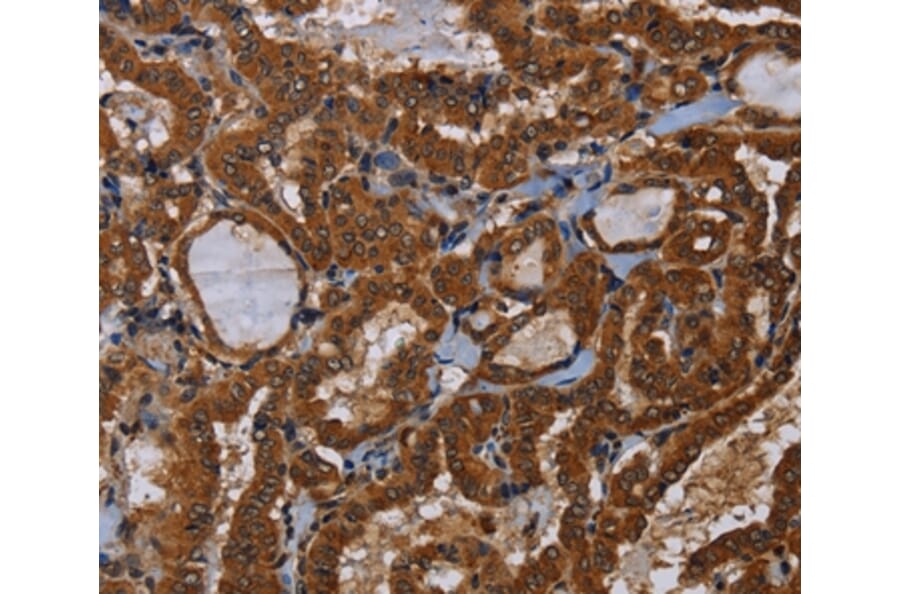 Immunohistochemistry - LRRC57 Antibody from Signalway Antibody (36590) - Antibodies.com