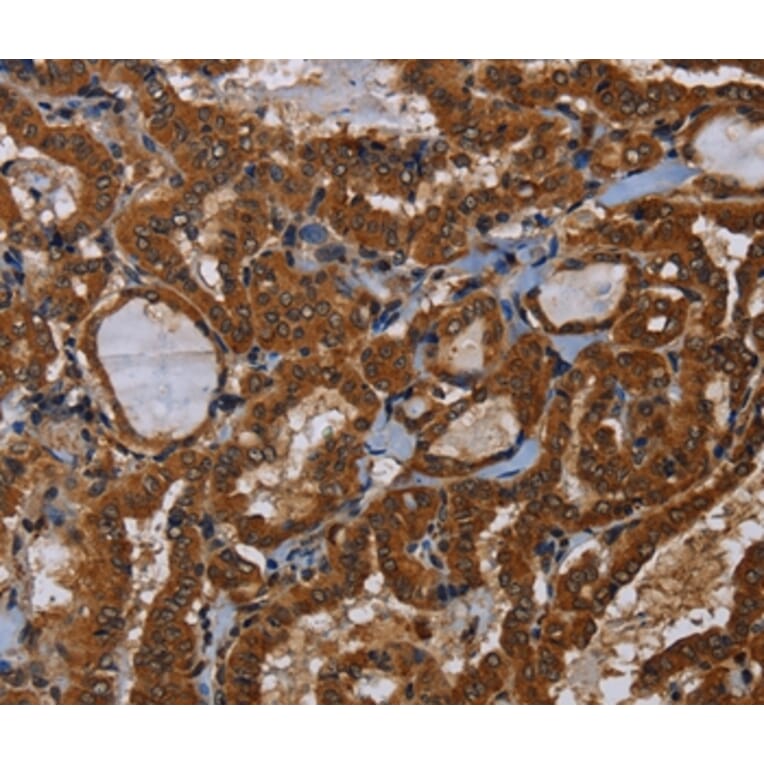 Immunohistochemistry - LRRC57 Antibody from Signalway Antibody (36590) - Antibodies.com
