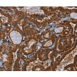 Immunohistochemistry - LRRC57 Antibody from Signalway Antibody (36590) - Antibodies.com