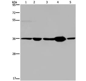 LZTFL1 Antibody from Signalway Antibody (36593) - Antibodies.com