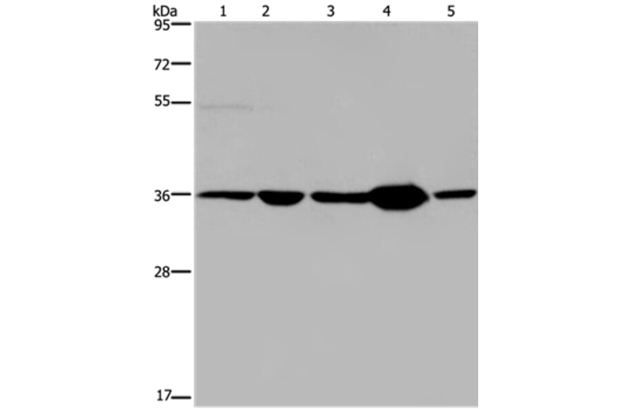 LZTFL1 Antibody from Signalway Antibody (36593) - Antibodies.com