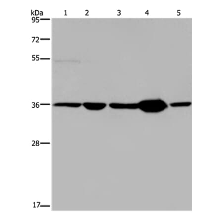 LZTFL1 Antibody from Signalway Antibody (36593) - Antibodies.com