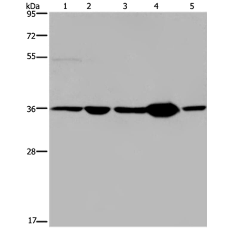 LZTFL1 Antibody from Signalway Antibody (36593) - Antibodies.com