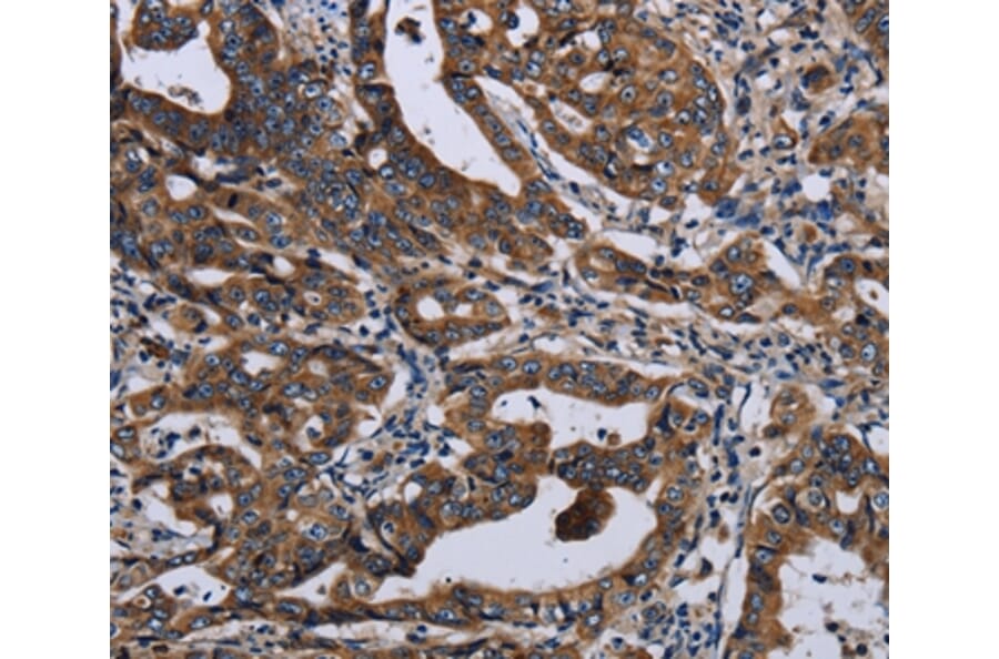 Immunohistochemistry - LZTFL1 Antibody from Signalway Antibody (36593) - Antibodies.com