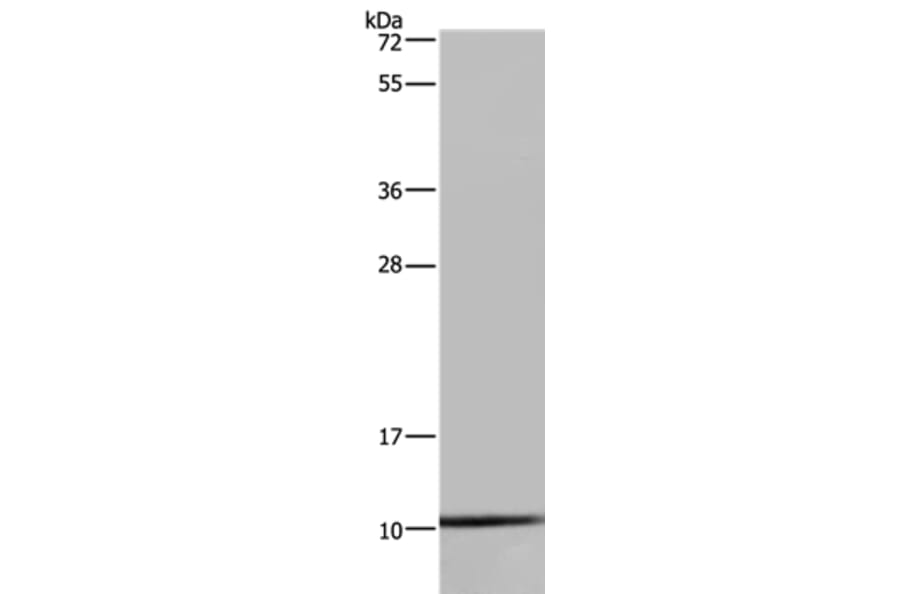 NDUFA1 Antibody from Signalway Antibody (36636) - Antibodies.com
