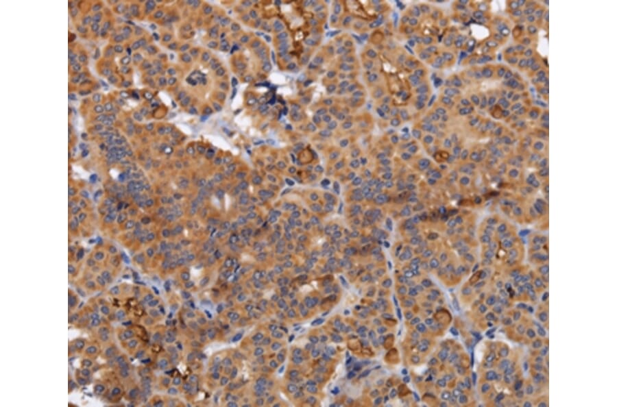 Immunohistochemistry - NDUFA1 Antibody from Signalway Antibody (36636) - Antibodies.com