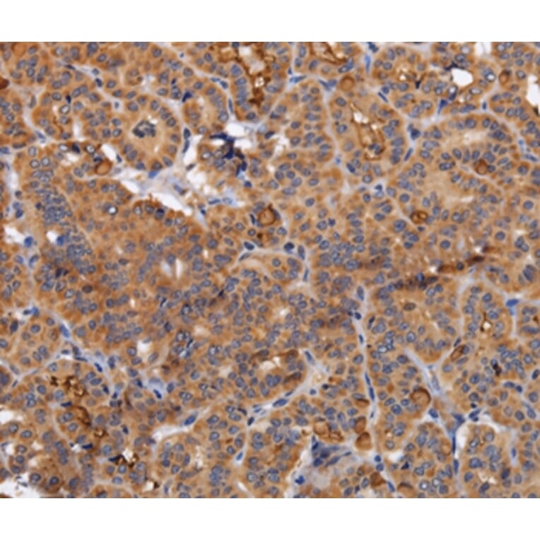 Immunohistochemistry - NDUFA1 Antibody from Signalway Antibody (36636) - Antibodies.com