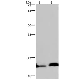 NDUFA5 Antibody from Signalway Antibody (36638) - Antibodies.com