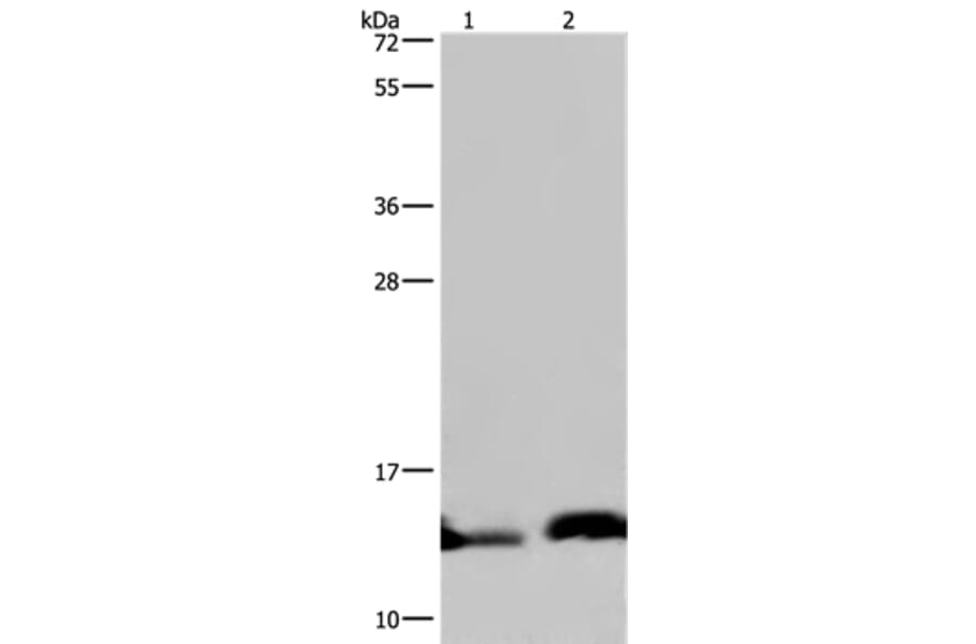 NDUFA5 Antibody from Signalway Antibody (36638) - Antibodies.com
