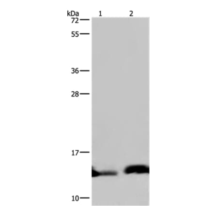 NDUFA5 Antibody from Signalway Antibody (36638) - Antibodies.com