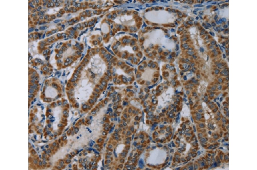Immunohistochemistry - NDUFA5 Antibody from Signalway Antibody (36638) - Antibodies.com