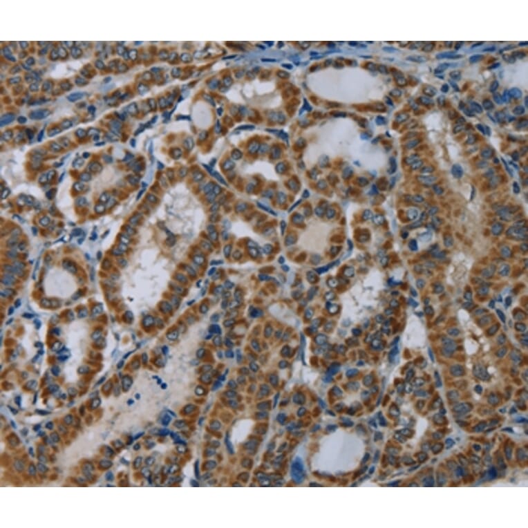 Immunohistochemistry - NDUFA5 Antibody from Signalway Antibody (36638) - Antibodies.com