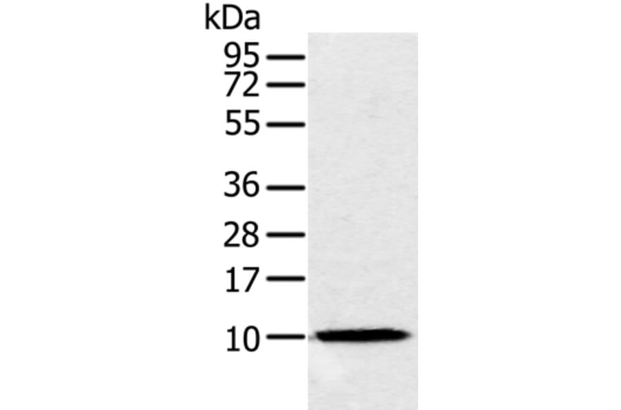 NDUFA2 Antibody from Signalway Antibody (36640) - Antibodies.com