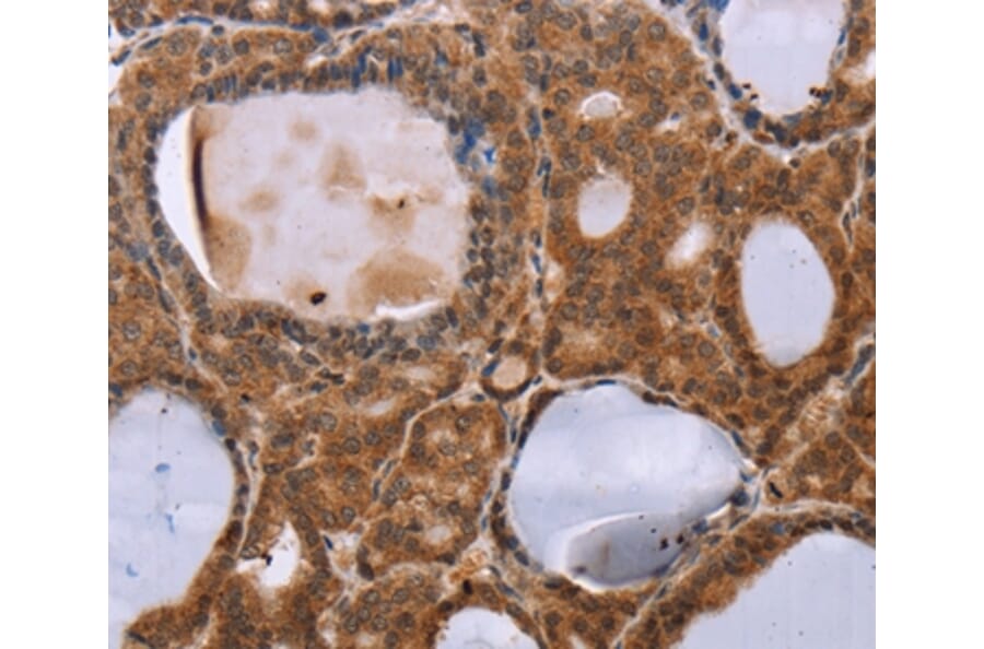 Immunohistochemistry - NDUFA2 Antibody from Signalway Antibody (36640) - Antibodies.com