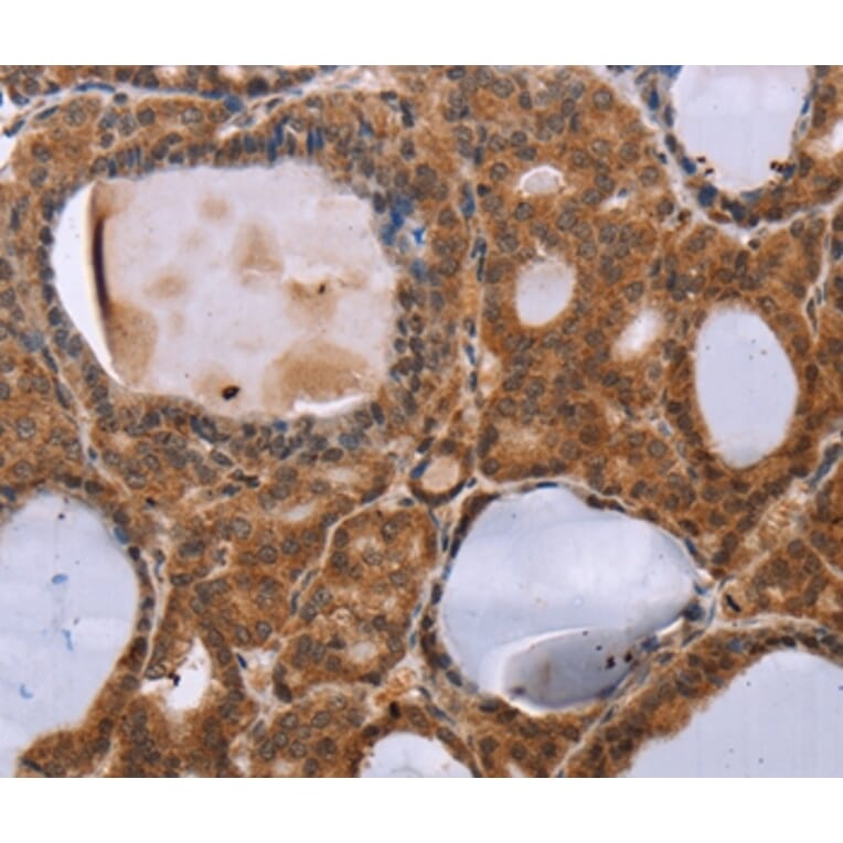 Immunohistochemistry - NDUFA2 Antibody from Signalway Antibody (36640) - Antibodies.com