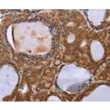 Immunohistochemistry - NDUFA2 Antibody from Signalway Antibody (36640) - Antibodies.com