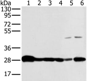NDUFS3 Antibody from Signalway Antibody (36641) - Antibodies.com