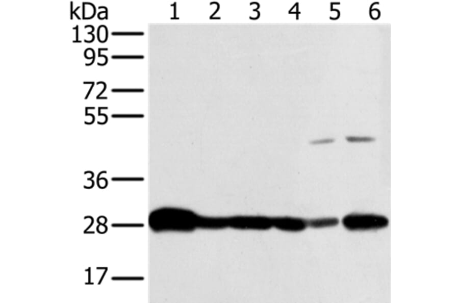 NDUFS3 Antibody from Signalway Antibody (36641) - Antibodies.com