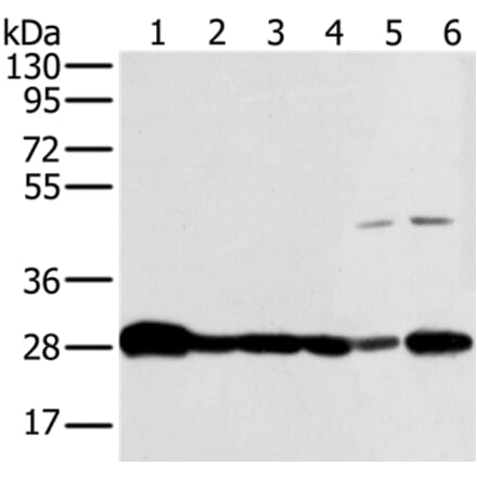 NDUFS3 Antibody from Signalway Antibody (36641) - Antibodies.com