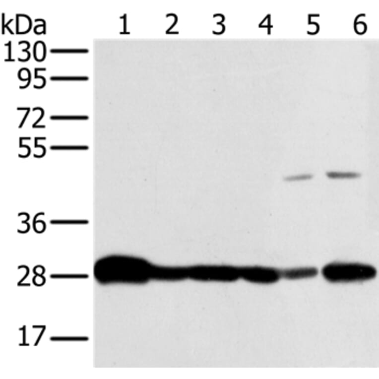 NDUFS3 Antibody from Signalway Antibody (36641) - Antibodies.com