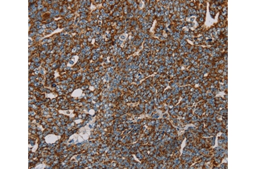 Immunohistochemistry - NDUFS3 Antibody from Signalway Antibody (36641) - Antibodies.com