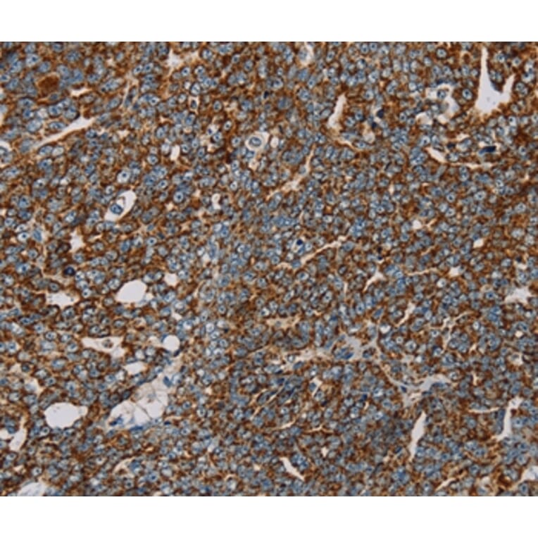 Immunohistochemistry - NDUFS3 Antibody from Signalway Antibody (36641) - Antibodies.com