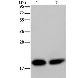 NDUFS4 Antibody from Signalway Antibody (36643) - Antibodies.com