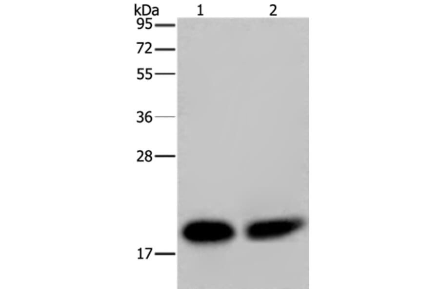 NDUFS4 Antibody from Signalway Antibody (36643) - Antibodies.com