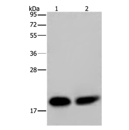 NDUFS4 Antibody from Signalway Antibody (36643) - Antibodies.com