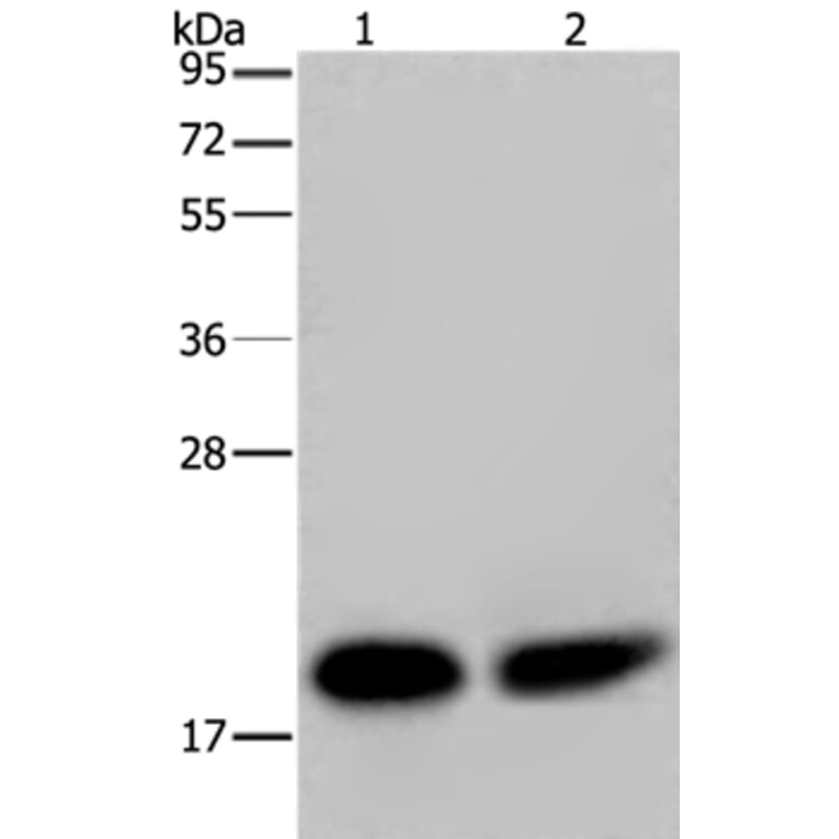 NDUFS4 Antibody from Signalway Antibody (36643) - Antibodies.com