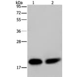 NDUFS4 Antibody from Signalway Antibody (36643) - Antibodies.com