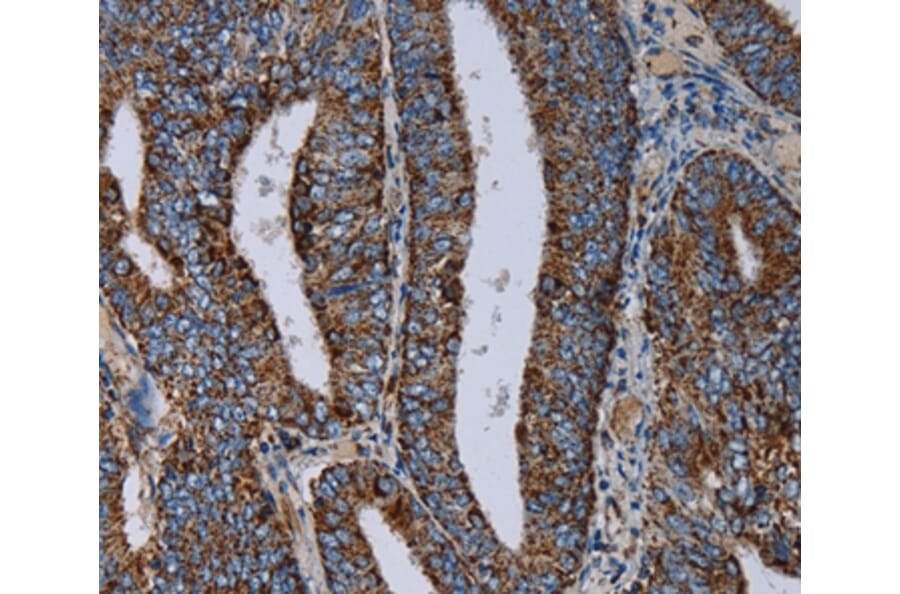 Immunohistochemistry - NDUFS4 Antibody from Signalway Antibody (36643) - Antibodies.com