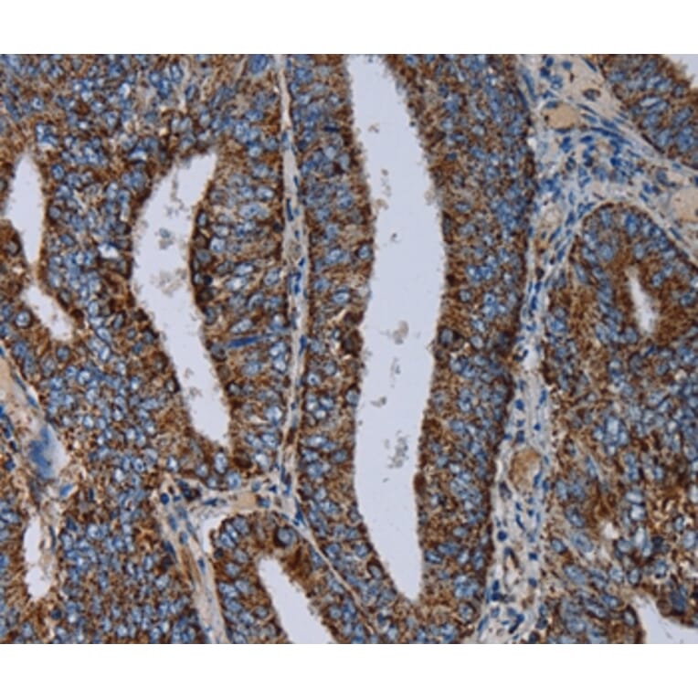 Immunohistochemistry - NDUFS4 Antibody from Signalway Antibody (36643) - Antibodies.com