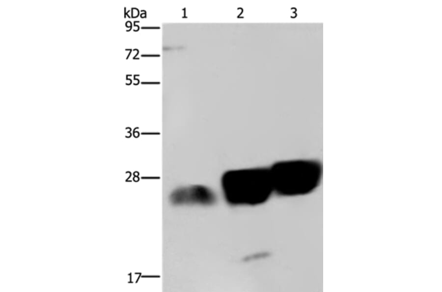 NDUFS8 Antibody from Signalway Antibody (36645) - Antibodies.com