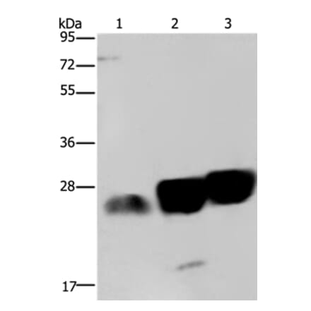 NDUFS8 Antibody from Signalway Antibody (36645) - Antibodies.com