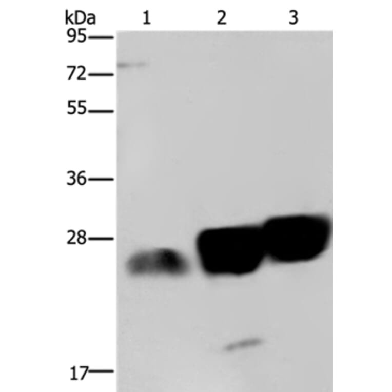 NDUFS8 Antibody from Signalway Antibody (36645) - Antibodies.com