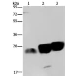 NDUFS8 Antibody from Signalway Antibody (36645) - Antibodies.com