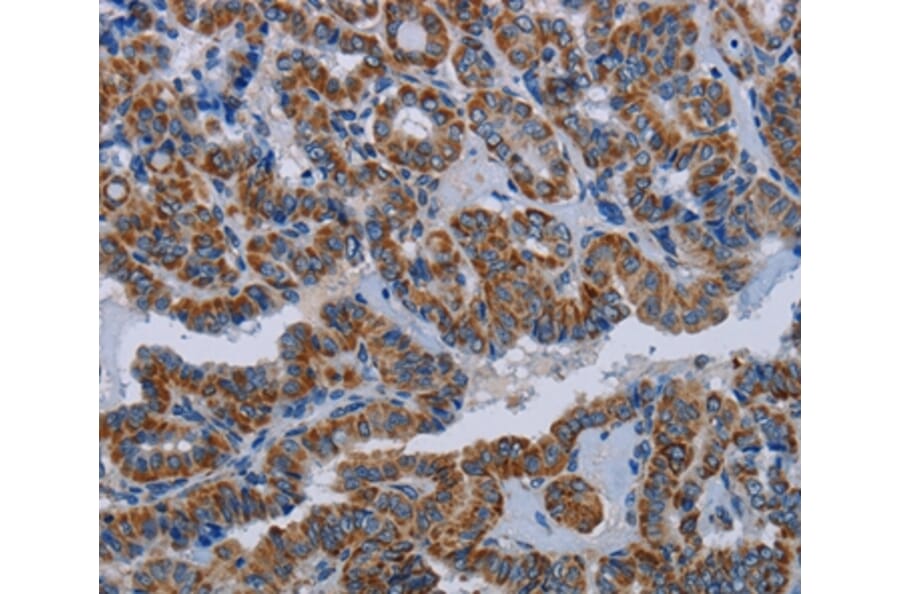 Immunohistochemistry - NDUFS8 Antibody from Signalway Antibody (36645) - Antibodies.com