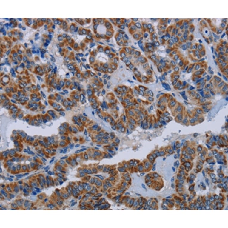 Immunohistochemistry - NDUFS8 Antibody from Signalway Antibody (36645) - Antibodies.com