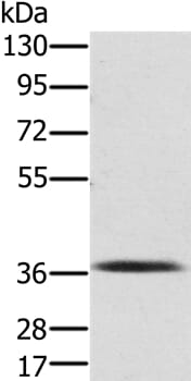 Gel: 8% SDS-PAGE Lysates (from left to right): Mouse liver tissue Amount of lysate: 40ug per lane Primary antibody: 1/250 dilution Secondary antibody dilution: 1/8000 Exposure time: 3 minutes
