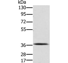PDLIM2 Antibody from Signalway Antibody (36687) - Antibodies.com