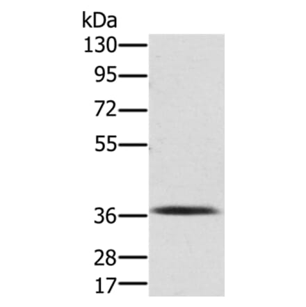 PDLIM2 Antibody from Signalway Antibody (36687) - Antibodies.com