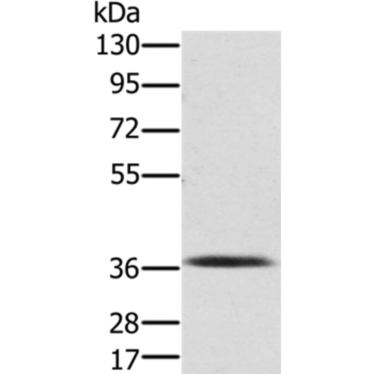 PDLIM2 Antibody from Signalway Antibody (36687) - Antibodies.com