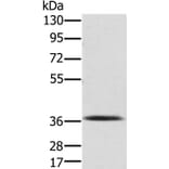 PDLIM2 Antibody from Signalway Antibody (36687) - Antibodies.com